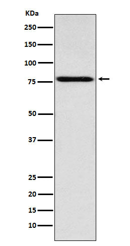 Western blot analysis of Coilin expression in Jurkat cell lysate.