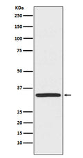 Western blot analysis of TRADD expression in Hela cell lysate.