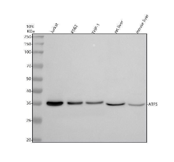Anti-ATF5 Rabbit Monoclonal Antibody