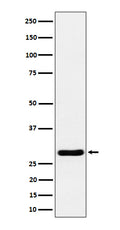 Western blot analysis of Calcipressin 1 expression in mouse heart cell lysate.