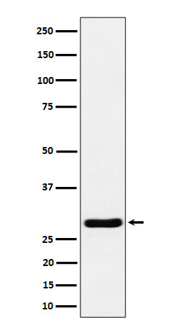 Western blot analysis of Calcipressin 1 expression in mouse heart cell lysate.