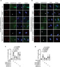 Anti-ACSS2/Acetyl Coa Synthetase Rabbit Monoclonal Antibody