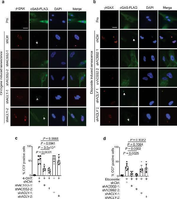 Anti-ACSS2/Acetyl Coa Synthetase Rabbit Monoclonal Antibody