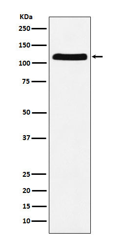 Western blot analysis of E1 Ubiquitin Activating Enzyme expression in HeLa cell lysate.