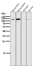All lanes use the Antibody at 1:2K dilution for 1 hour at room temperature.