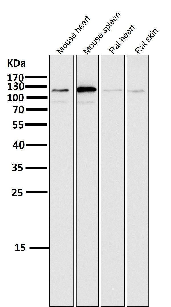 All lanes use the Antibody at 1:2K dilution for 1 hour at room temperature.