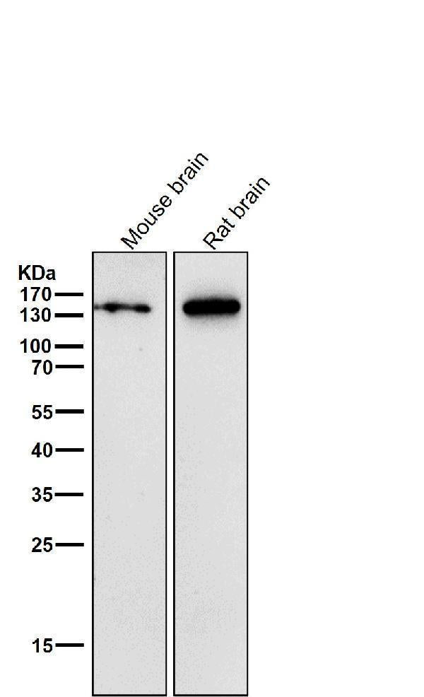 All lanes use the Antibody at 1:3K dilution for 1 hour at room temperature.