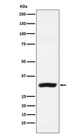 Western blot analysis of CBR1 expression in MCF-7 cell lysate.