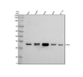Anti-CBR1 Rabbit Monoclonal Antibody