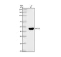 Anti-Cytokeratin 20 KRT20 Rabbit Monoclonal Antibody