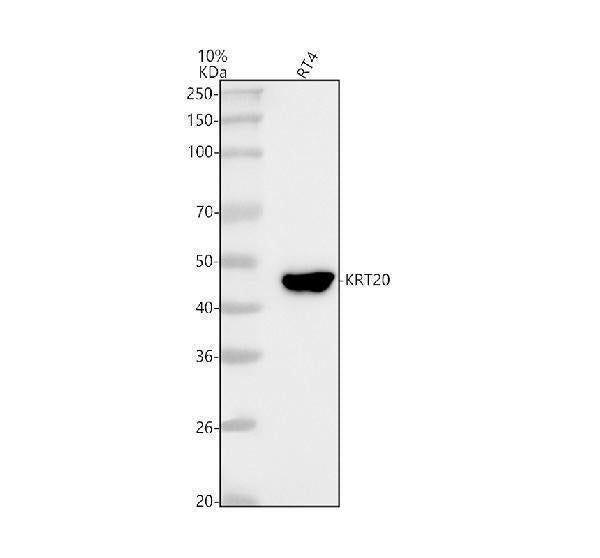 Anti-Cytokeratin 20 KRT20 Rabbit Monoclonal Antibody