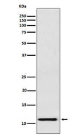 Western blot analysis of fetal hemoglobin expression in K562 cell lysate.