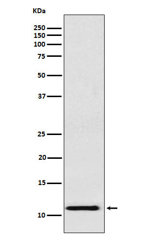 Western blot analysis of fetal hemoglobin expression in K562 cell lysate.