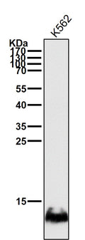 All lanes use the Antibody at 1:3K dilution for 1 hour at room temperature.