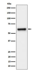 Western blot analysis of FPGS expression in HeLa cell lysate.