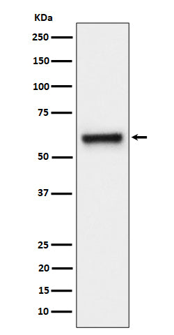 Western blot analysis of FPGS expression in HeLa cell lysate.