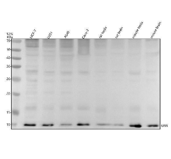 Anti-Ubiquitin UBB Rabbit Monoclonal Antibody