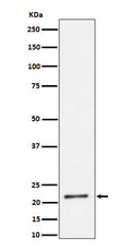 Western blot analysis of K27-linkage Specific Ubiquitin expression in HeLa cell lysate.