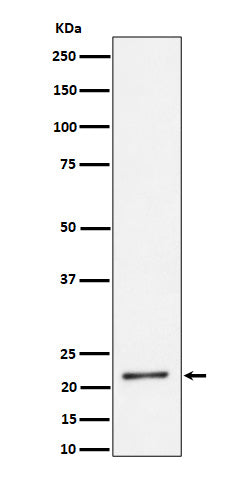 Western blot analysis of K27-linkage Specific Ubiquitin expression in HeLa cell lysate.