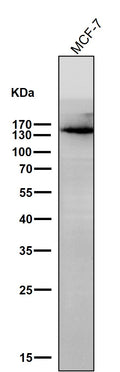 All lanes use the Antibody at 1:1K dilution for 1 hour at room temperature.