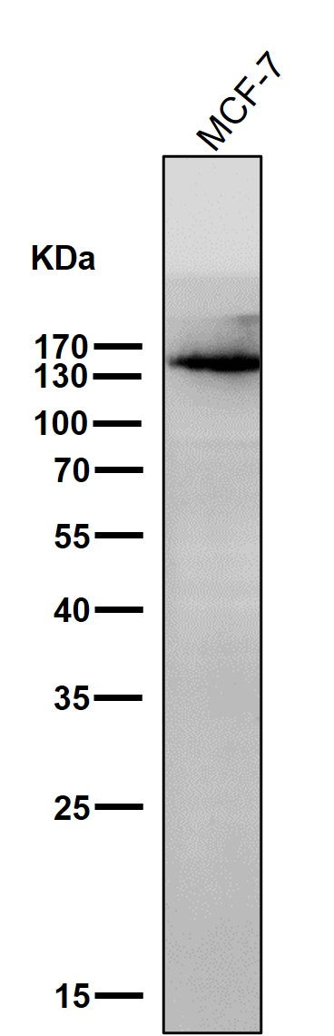 All lanes use the Antibody at 1:1K dilution for 1 hour at room temperature.