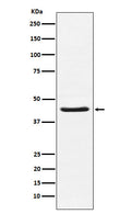 Western blot analysis of HSD3B1 expression in Human placenta lysate.