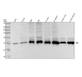 Anti-PSB9 / LMP2 Rabbit Monoclonal Antibody