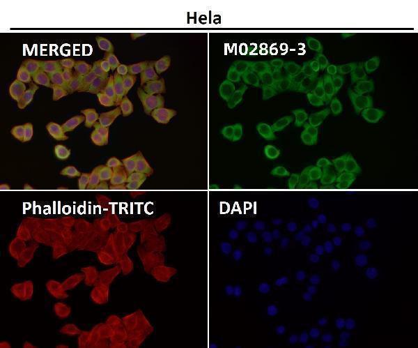 Immunofluorescent analysis using the Antibody at 1:50 dilution.