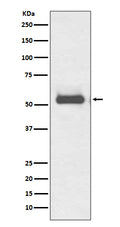 Western blot analysis of TRK fused gene expression in HeLa cell lysate.