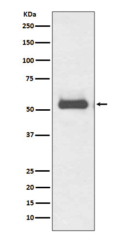 Western blot analysis of TRK fused gene expression in HeLa cell lysate.