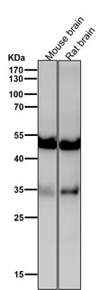 All lanes use the Antibody at 1:1K dilution for 1 hour at room temperature.
