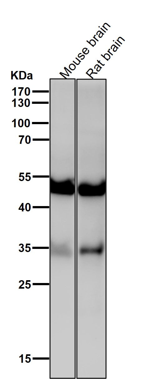 All lanes use the Antibody at 1:1K dilution for 1 hour at room temperature.