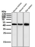 All lanes use the Antibody at 1:1K dilution for 1 hour at room temperature.