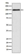 Western blot analysis of COL11A1 expression in K562 cell lysate.