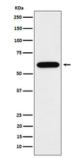 Western blot analysis of TUB1 expression in Neuro-2a cell lysate.