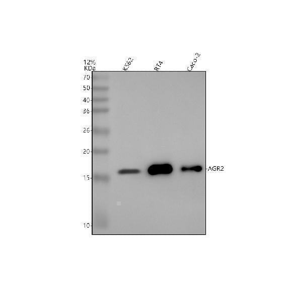 Anti-AGR2/Ag 2 Rabbit Monoclonal Antibody