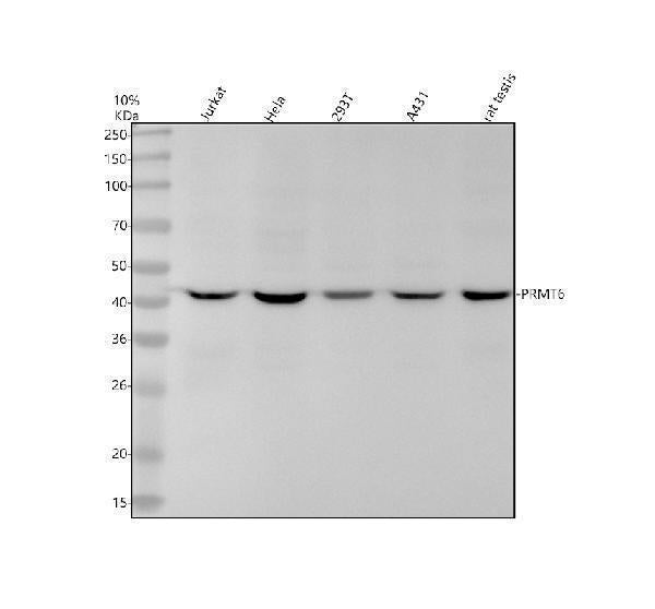 Anti-PRMT6 Rabbit Monoclonal Antibody