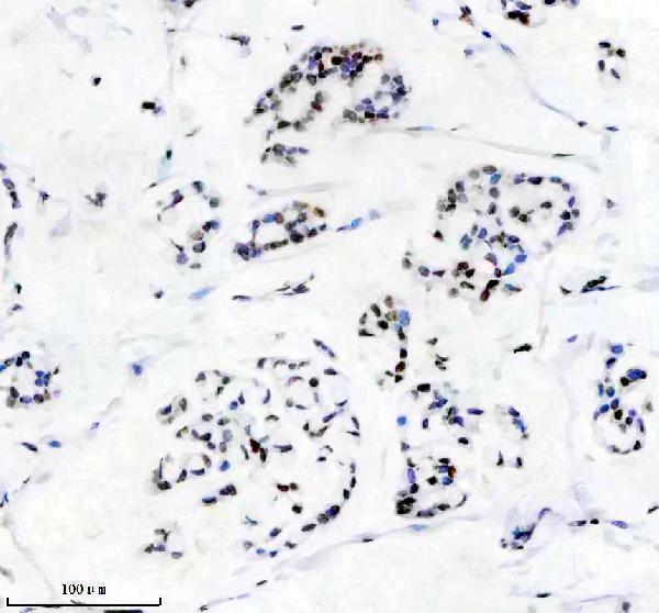 Anti-Matrin 3 Rabbit Monoclonal Antibody
