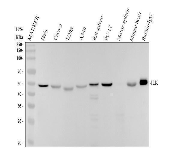 Anti-ILK/Integrin Linked Ilk Rabbit Monoclonal Antibody