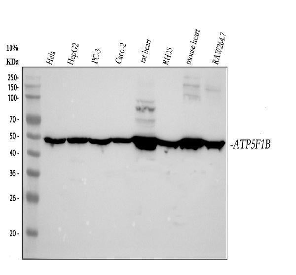 Anti-ATPB Rabbit Monoclonal Antibody
