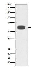Western blot analysis of PLAT expression in human plasma lysate.