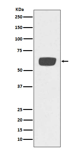 Western blot analysis of PLAT expression in human plasma lysate.