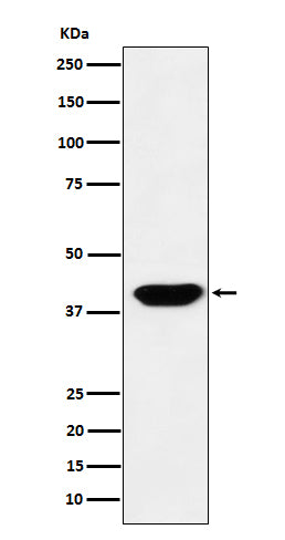 Western blot analysis of Islet1 expression in HeLa cell lysate.