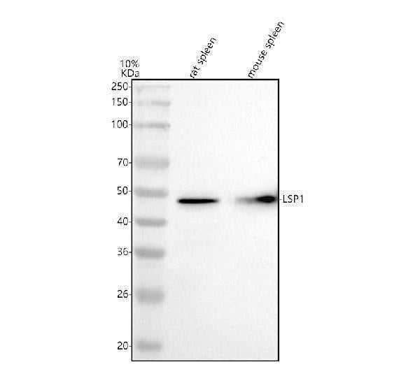 Anti-LSP1 Rabbit Monoclonal Antibody