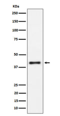 Western blot analysis of IL15RA expression in Raji cell lysate.