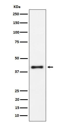 Western blot analysis of IL15RA expression in Raji cell lysate.
