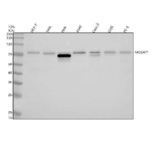 Anti-RGAP1 Rabbit Monoclonal Antibody