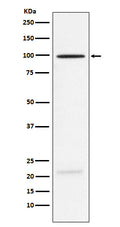 Western blot analysis of MAG expression in Rat brain lysate.