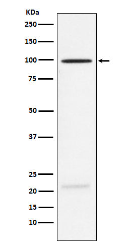 Western blot analysis of MAG expression in Rat brain lysate.