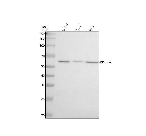 Anti-Calcineurin A Rabbit Monoclonal Antibody